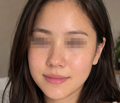 After